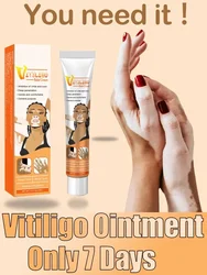 Pomada de Vitiligo para eliminar eficazmente las manchas blancas, elimina el Vitiligo de la piel, cuidado de la piel corporal