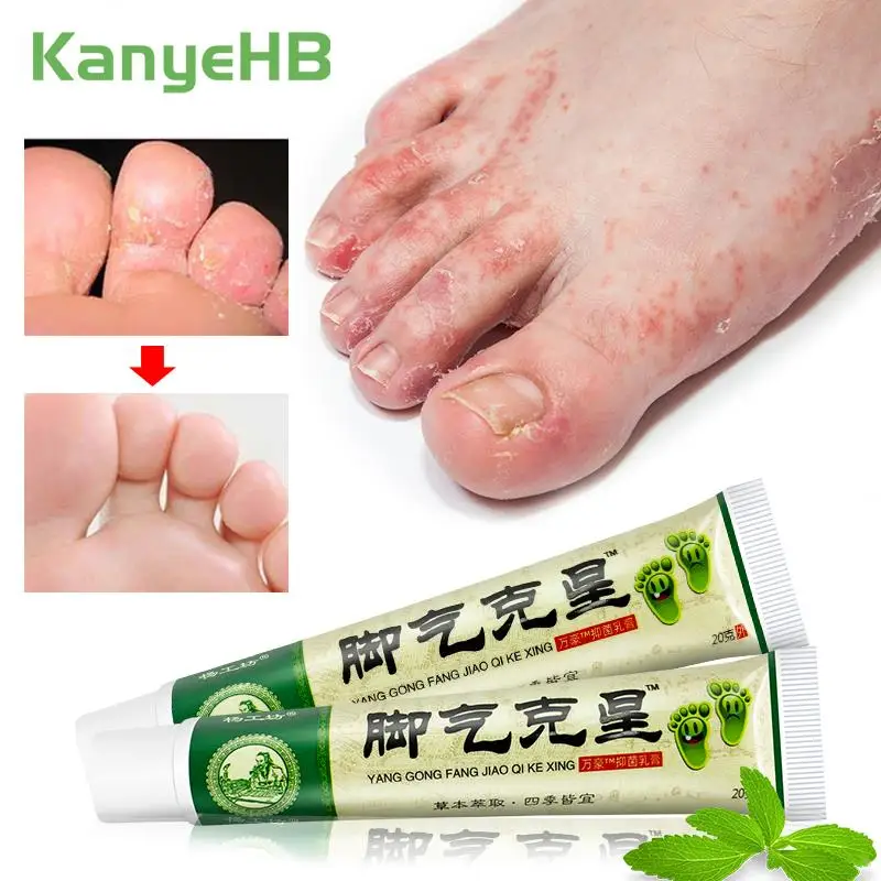 2pcs Foot Tinea Pedis Treatment Cream Treat Beriberi Ointment Anti-itch Inhibits Fungus Peeling Athlete Foot Medical Cream A941