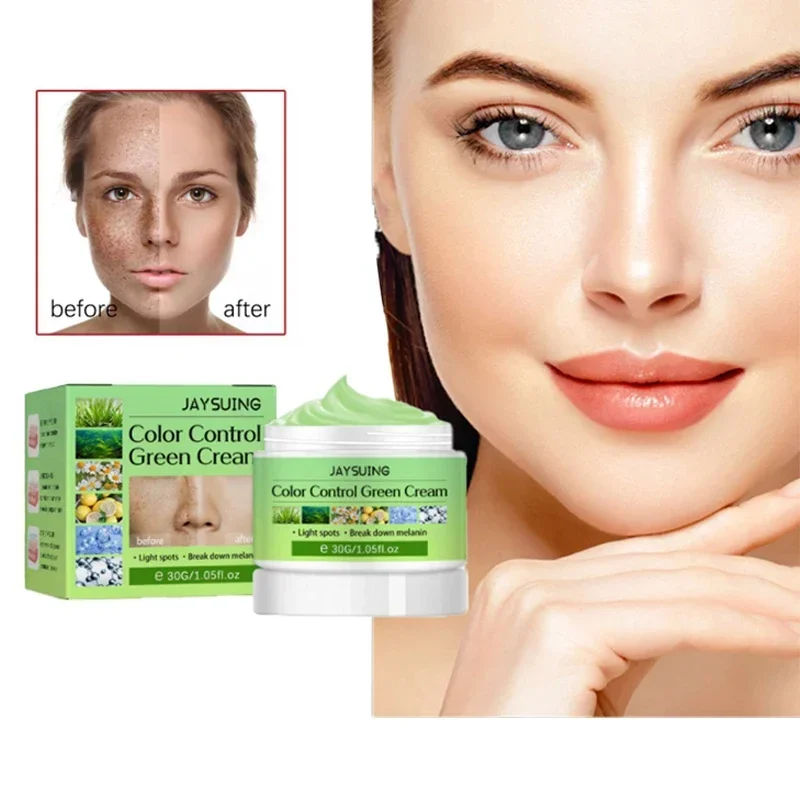 

Color control spot removal green cream freckle pigment decomposition rejuvenation and beautiful skin cream spot nevi