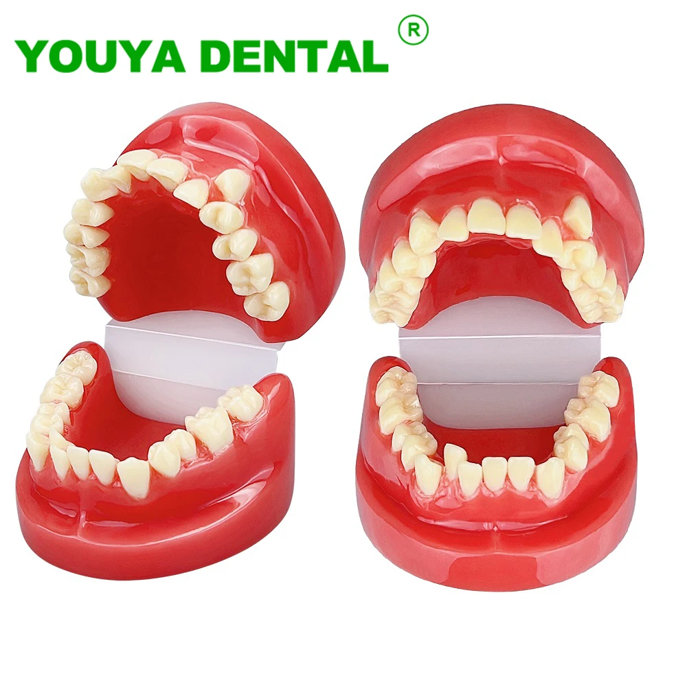 Orthodontic Model Dental Teeth Teaching Model Typodont Jaw Model Dentistry Demonstration Products For Patient Communication NEW