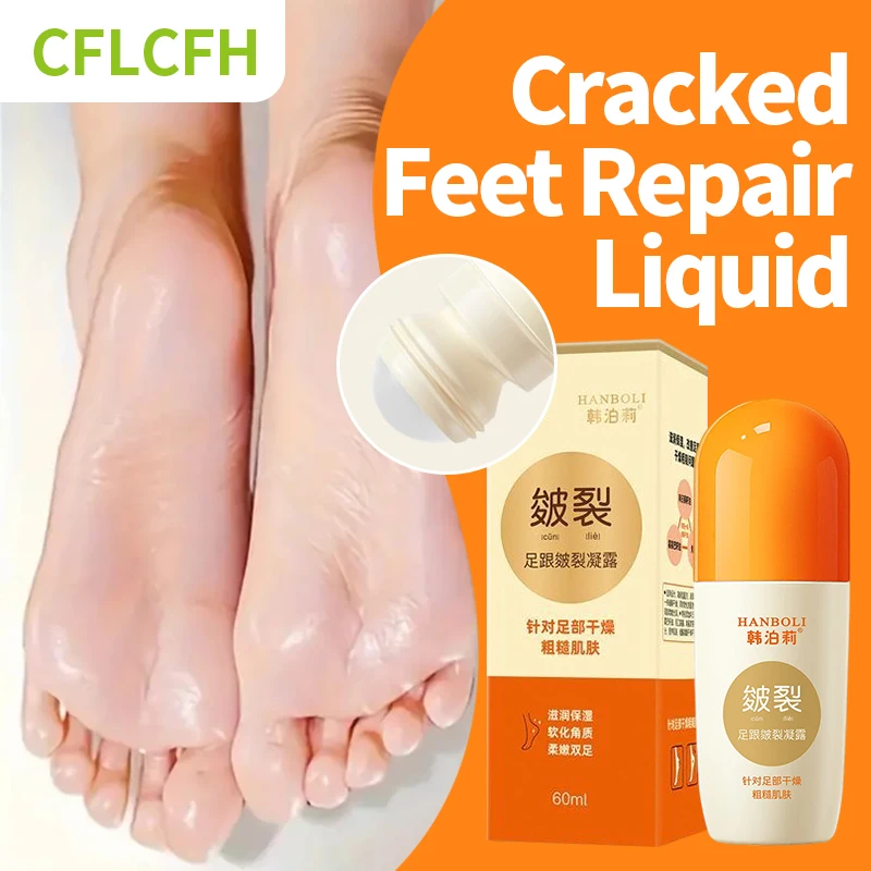 

Anti Crack Foot Care Cream Drying Cracked Feet Repair Hand Heel Dead Skin Removal Dew Chapped Peeling Moisturizing Foot Mask