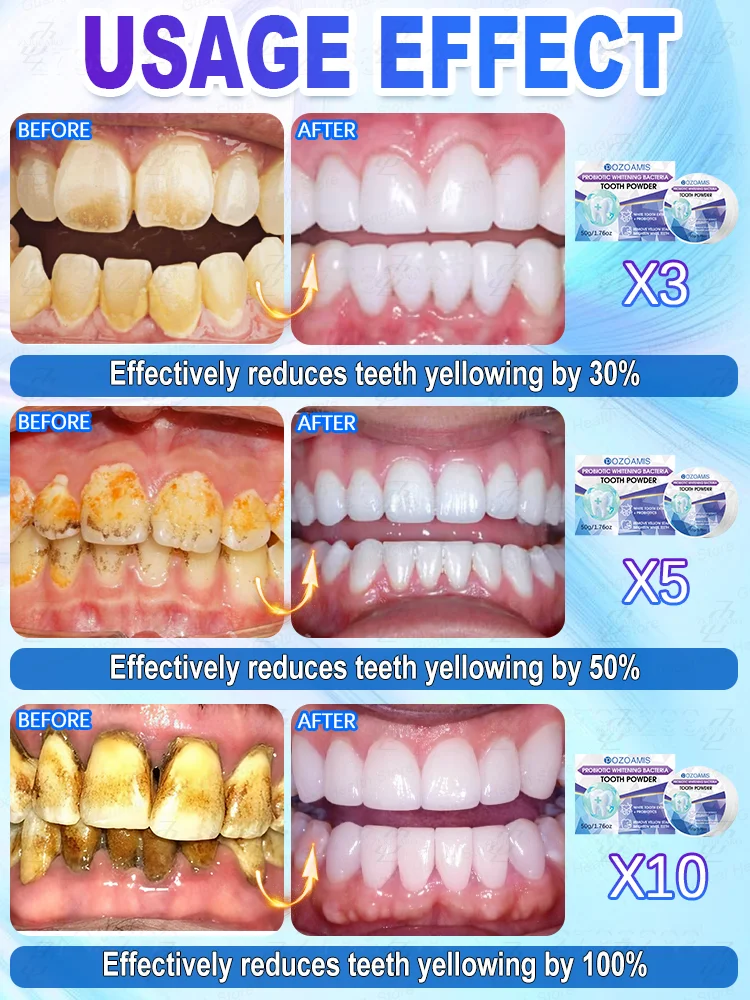 Profesjonalny proszek do wybielania zębów, szybko wybiela zęby i usuwa osad.