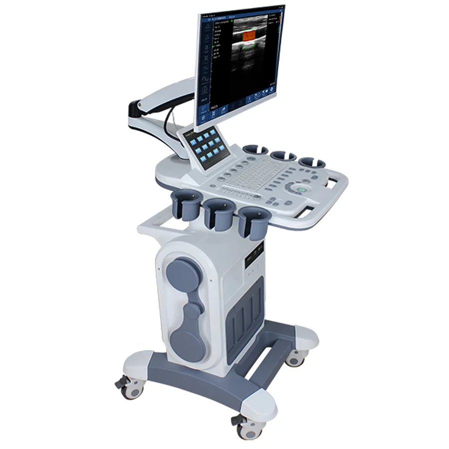 

Customized Color Doppler 4D Echo Sonography, Wireless Trolley Doppler Ultrasound