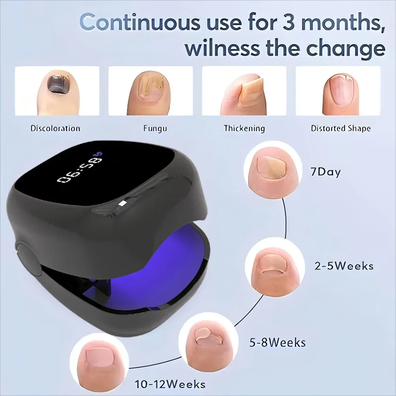 Weiß/Schwarz Pilz Nagel Laser Gerät Reparatur Nägel Pilz Onychomykose Nagel Pilz Reinigung Laser Gerät Fuß Nagel Pflege Werkzeuge