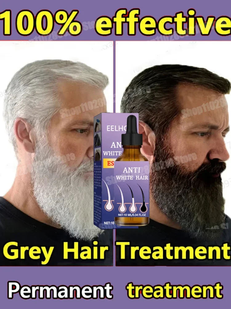 White hair killer, remove gray hair and restore natural hair color in 7 days