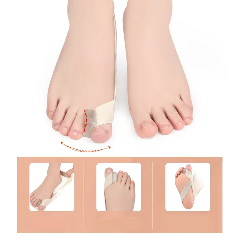 Hallux Valgus Corrector One Side Thumb Valgus Corrector Tension Strap Pain Relief Toefinger Separator Toe Straightener Tool