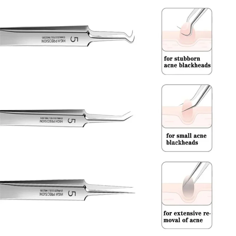 German Ultra-fine No. 5 Cell Pimples Blackhead Clip Tweezers Beauty Salon Special Scraping & Closing Artifact Acne Needle Tool