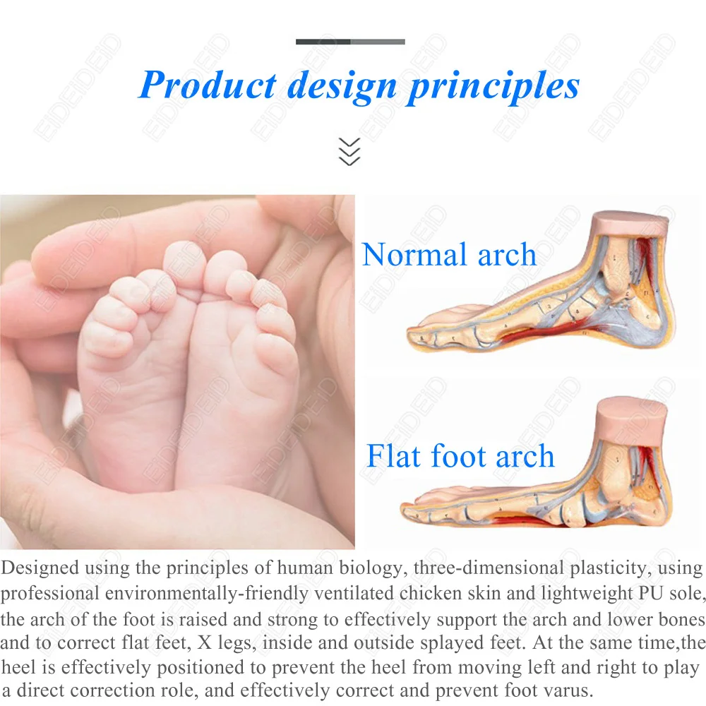 3D-Orthopädische Einlegesohlen für Plattfüße bei Kindern und Erwachsenen, Gewölbestütze für X-Beine, Orthopädische Schuh-Fersenpolster-Einlagen – Detail 1