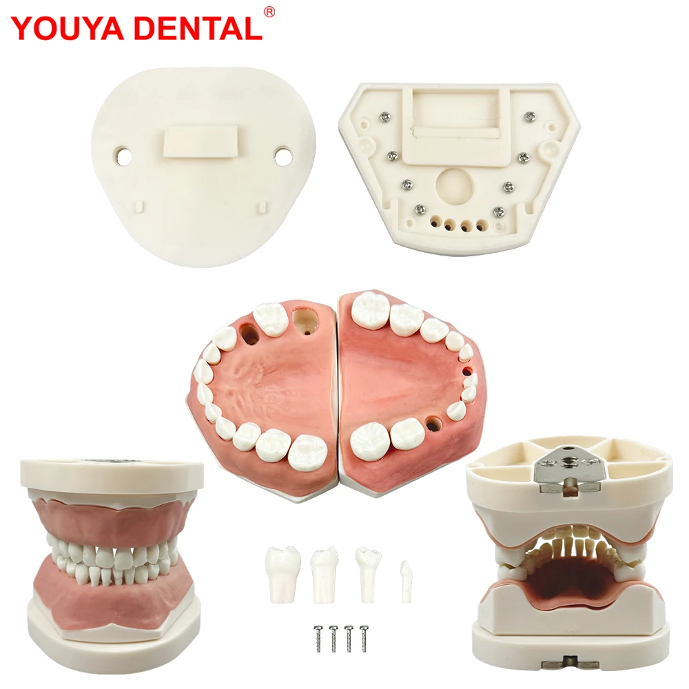 Kids Deciduous Teeth Practice Model With Removable Tooth 24 Teeth Child Primary Tooth Typodont Jaws For Training Teaching Study