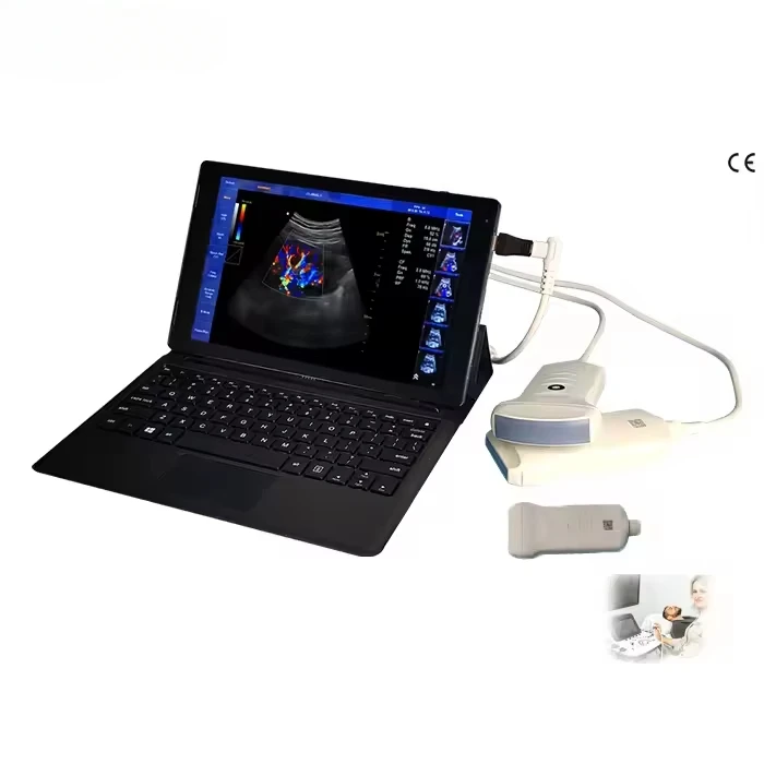 

Handheld Color Doppler Probe SUN-901B Linear Probe Ultrasound Scanner Probe