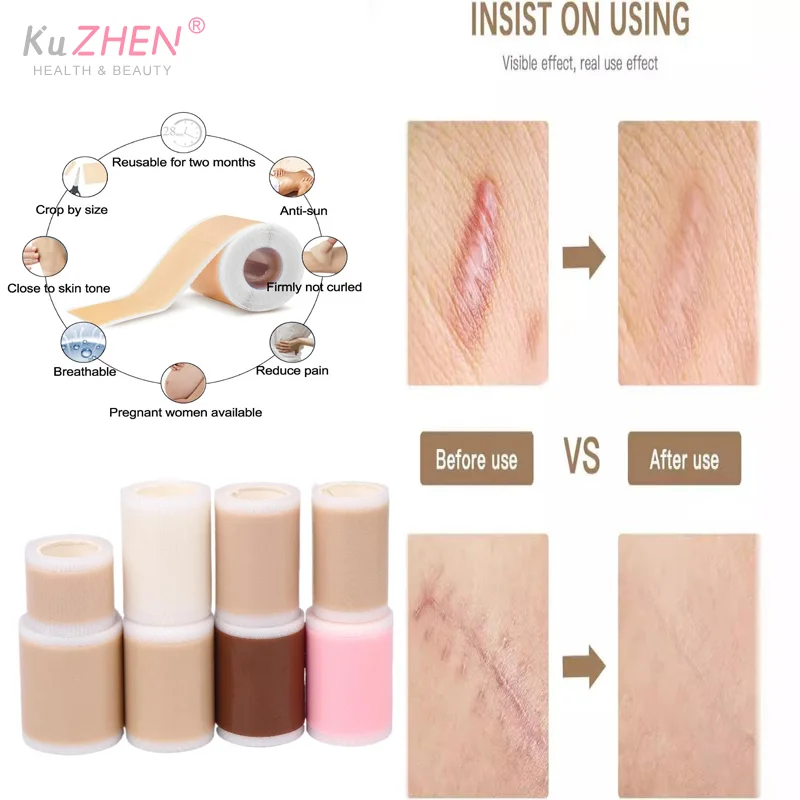 

1 рулон, силиконовый гель, пластырь для лечения шрамов, лента для удаления покрытия, ожогов, травм, ремонт прыщей, уха, шрамов, секция, красота кожи