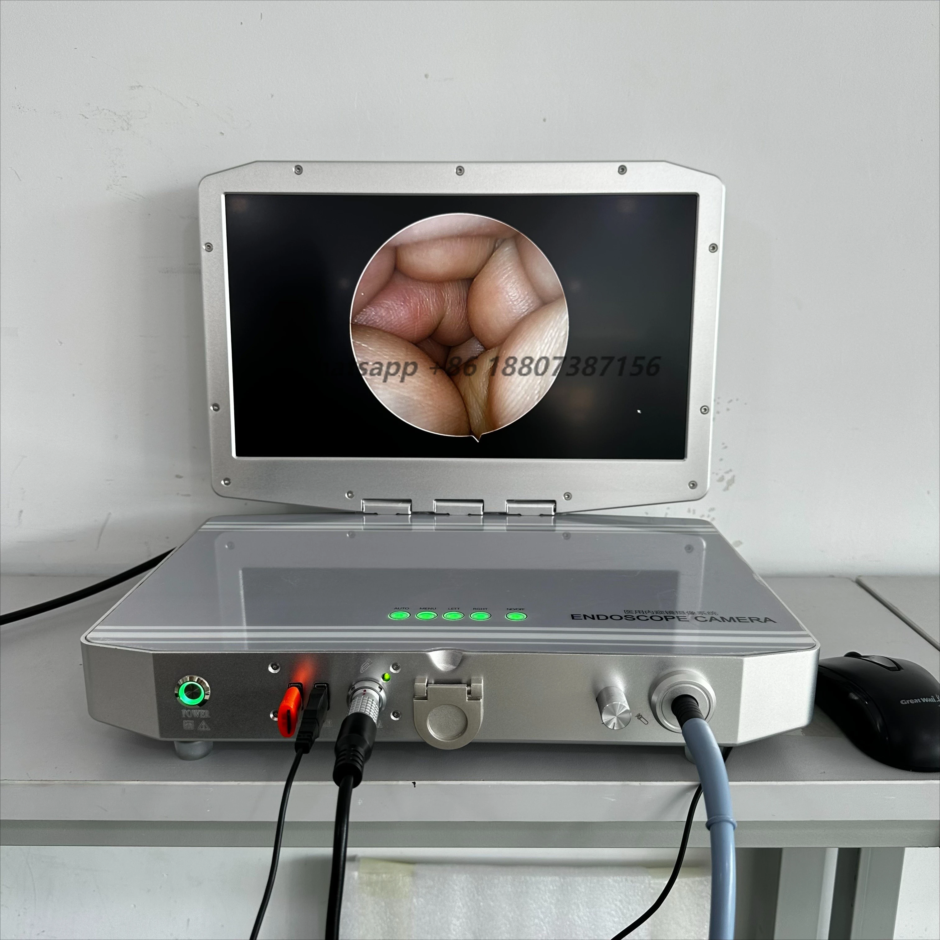 Taljoy Portable Diagnostic ENT Endoscopic  with Medical Display and LED Light Source