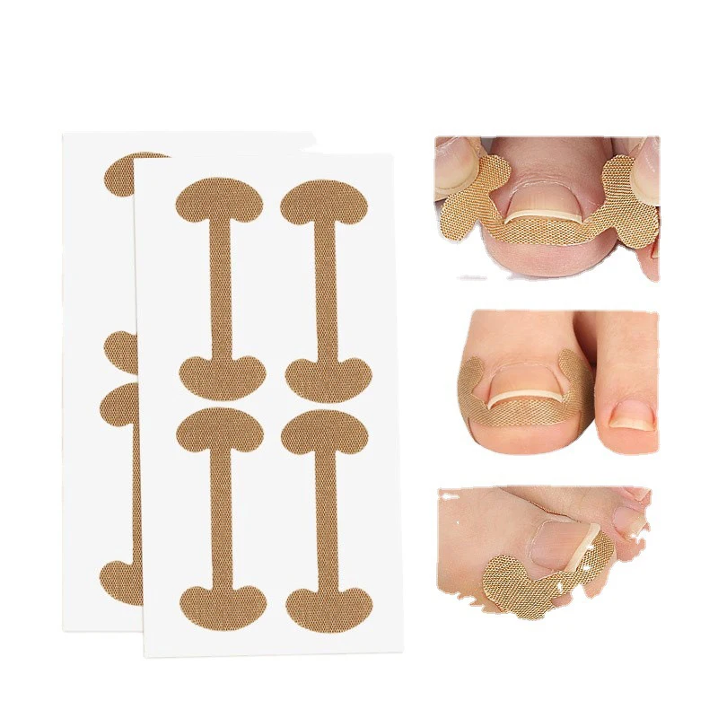 Autocollants pour la ration des ongles incarnés, patchs pour le traitement de l'amitié, la récupération, outil de soins de pédicure