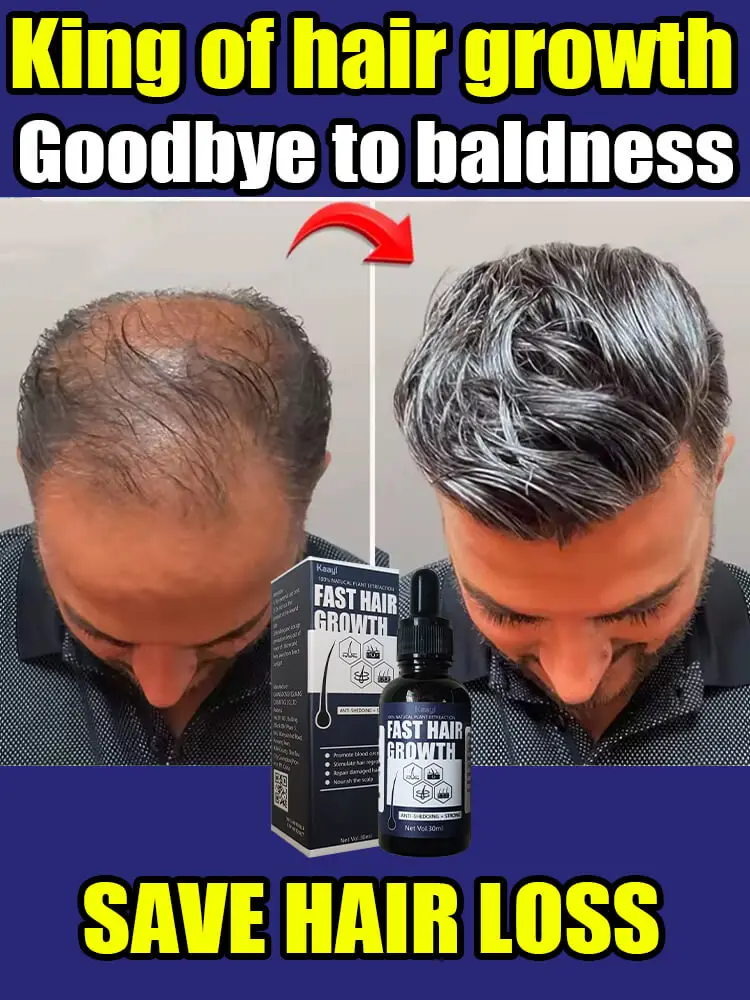 скажи прощай, облысение