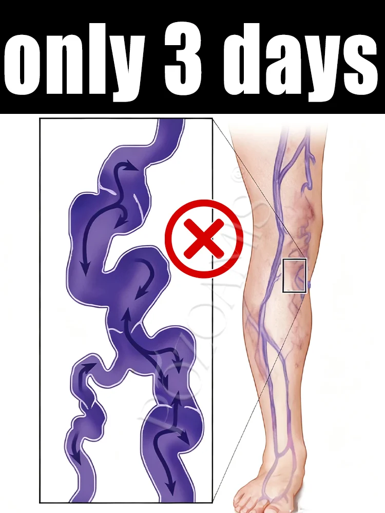 

Hot-selling products in 2025: Massage tools, leg soreness relief products