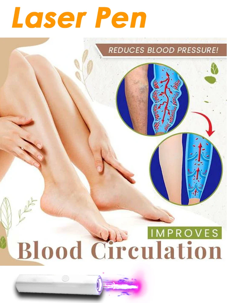 

Laser Therapy Veins Pen For Varicose Veins Chinese Herbal Essence Veins Cream 30g Relieves Spider Veins Leg Care