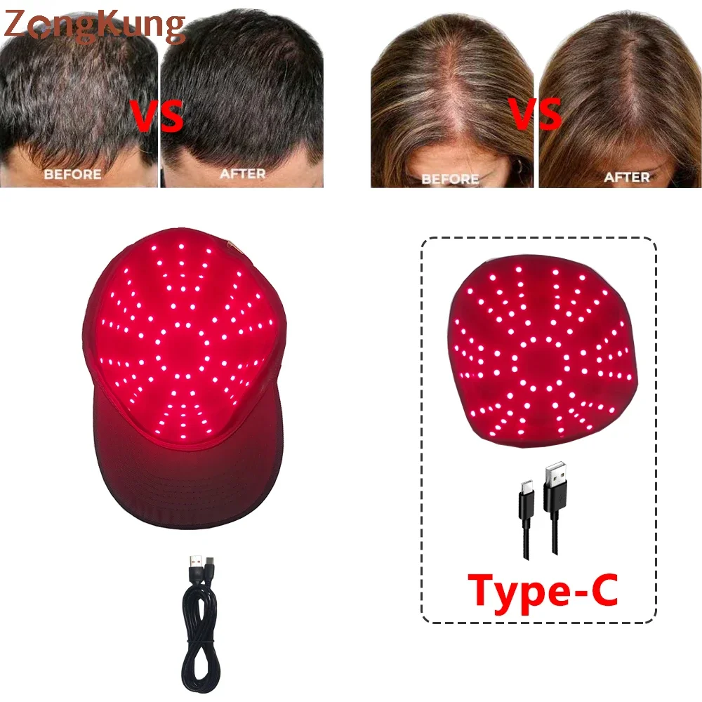 

96pcs LED Red Light Therapy Cap 660&850 nm Infrared Light ，for Hair Fast Growth Regrowth Anti Hair Loss Relax Scalp Care Hat