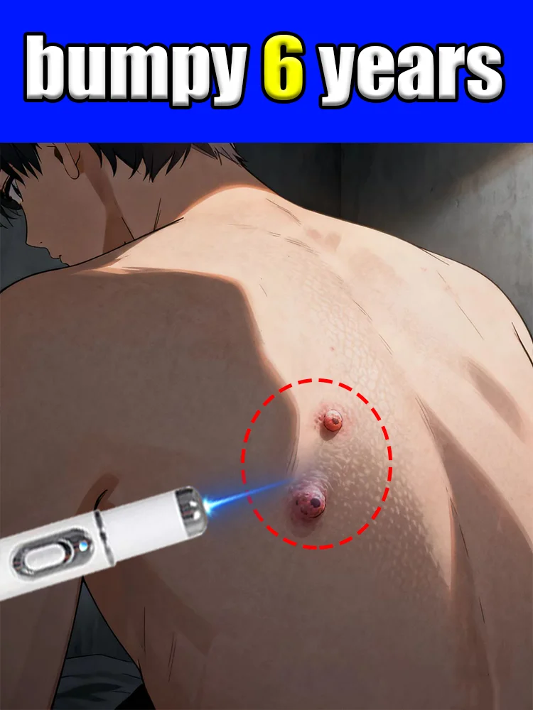 

Say goodbye to all warts in 7 days and feel comfortable all over