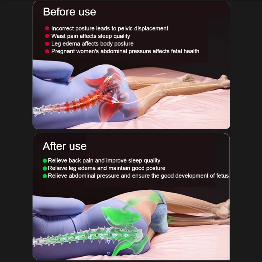 임신 하트 모양 다리 베개, 출산 바디 간호 메모리 코튼 부종 완화, 임산부 측면 수면
