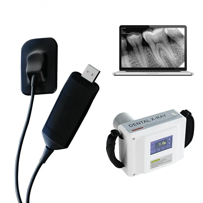 

2024 hot sales rvg sensor digital xray sensor with softwarexray digital sensor for Clinics & Hospital