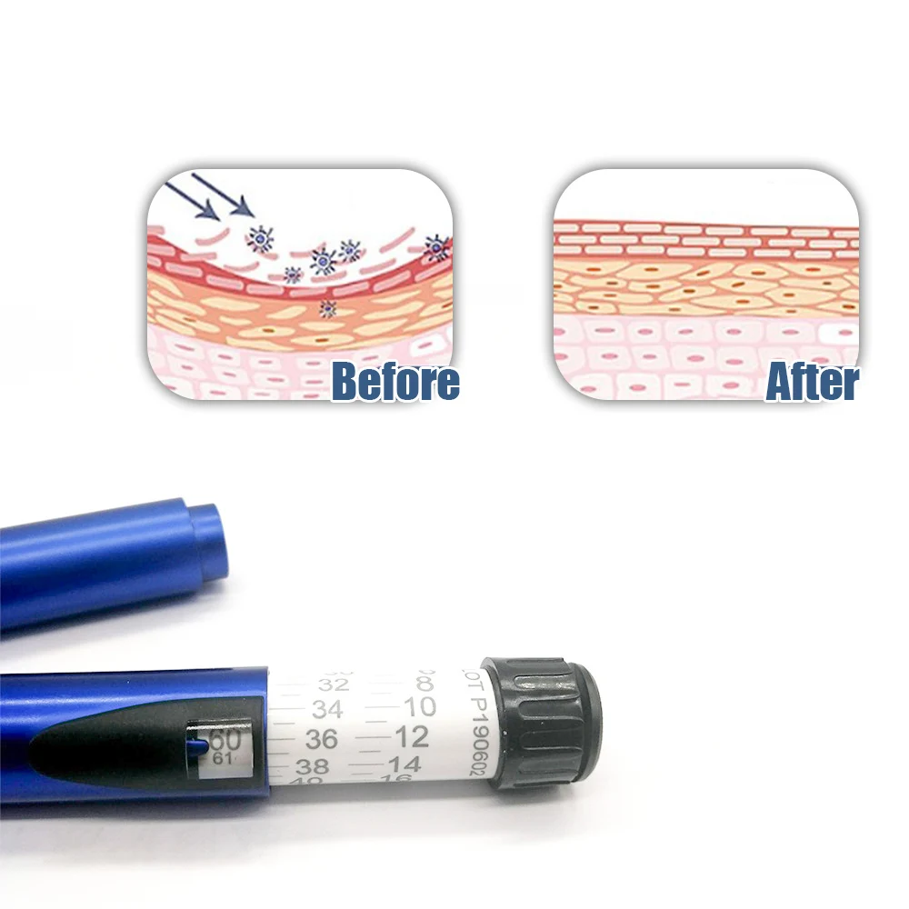 1/2/3/5 قطعة قلم سحري العناية بالتجاعيد الوجه مزيل القلم المضادة للتجاعيد أداة ل ليلي الأنسولين حقن القلم جماليات طبية #3