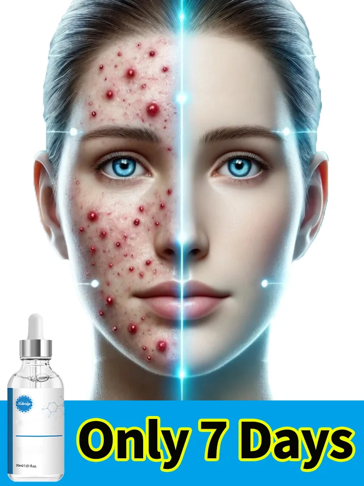 

face skin for bad Can be in 7 days farewell