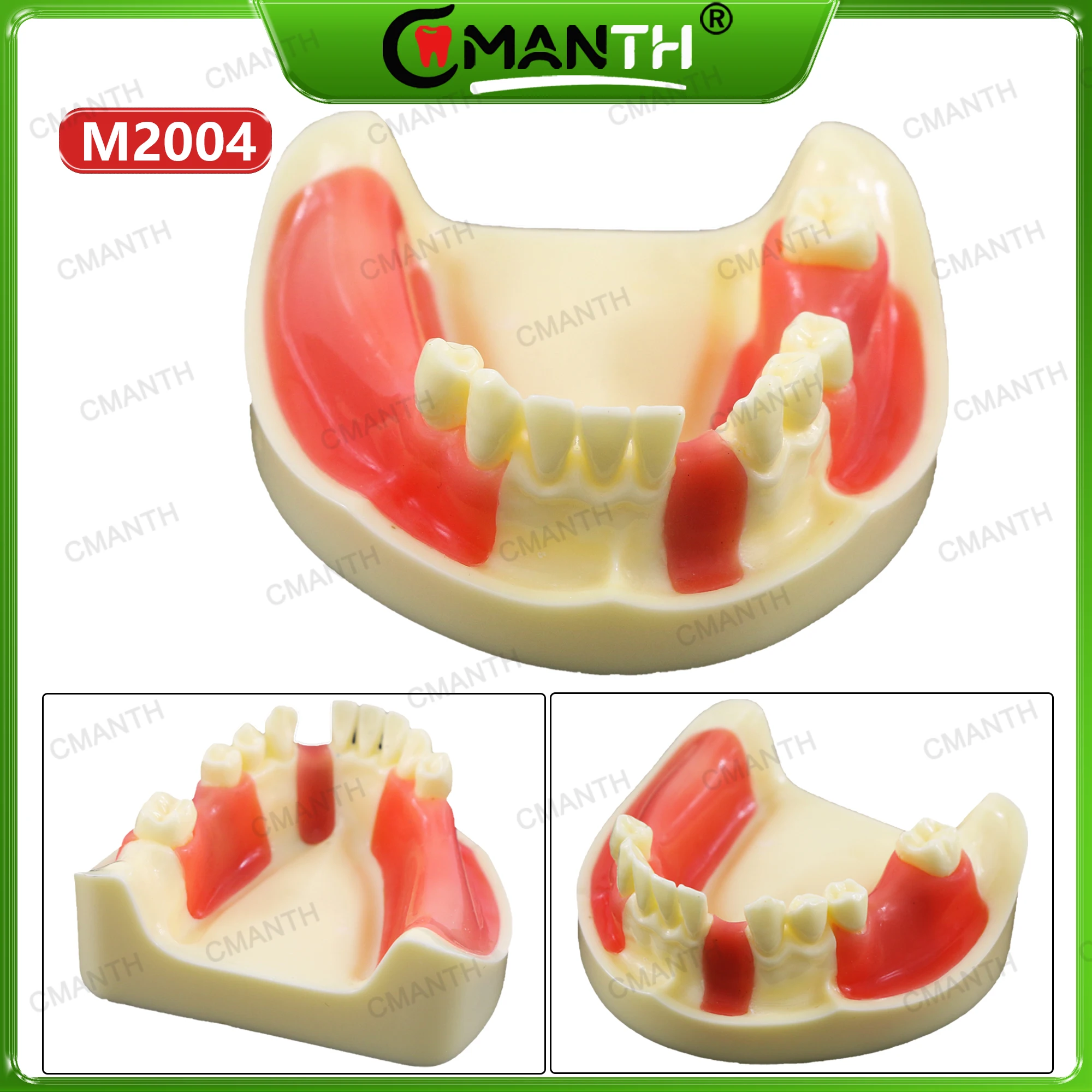 

Dental Model Lower Jaw Implant Drilling Practice Teeth Model Gingiva Removable M2004 For Training Dentistry Student Practice