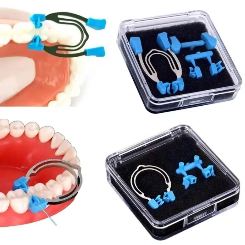 Lab Matrix Sectional Contoured Metal Spring Clip Rings Clamps Wedges Forming Sheet Clips Lab Tools