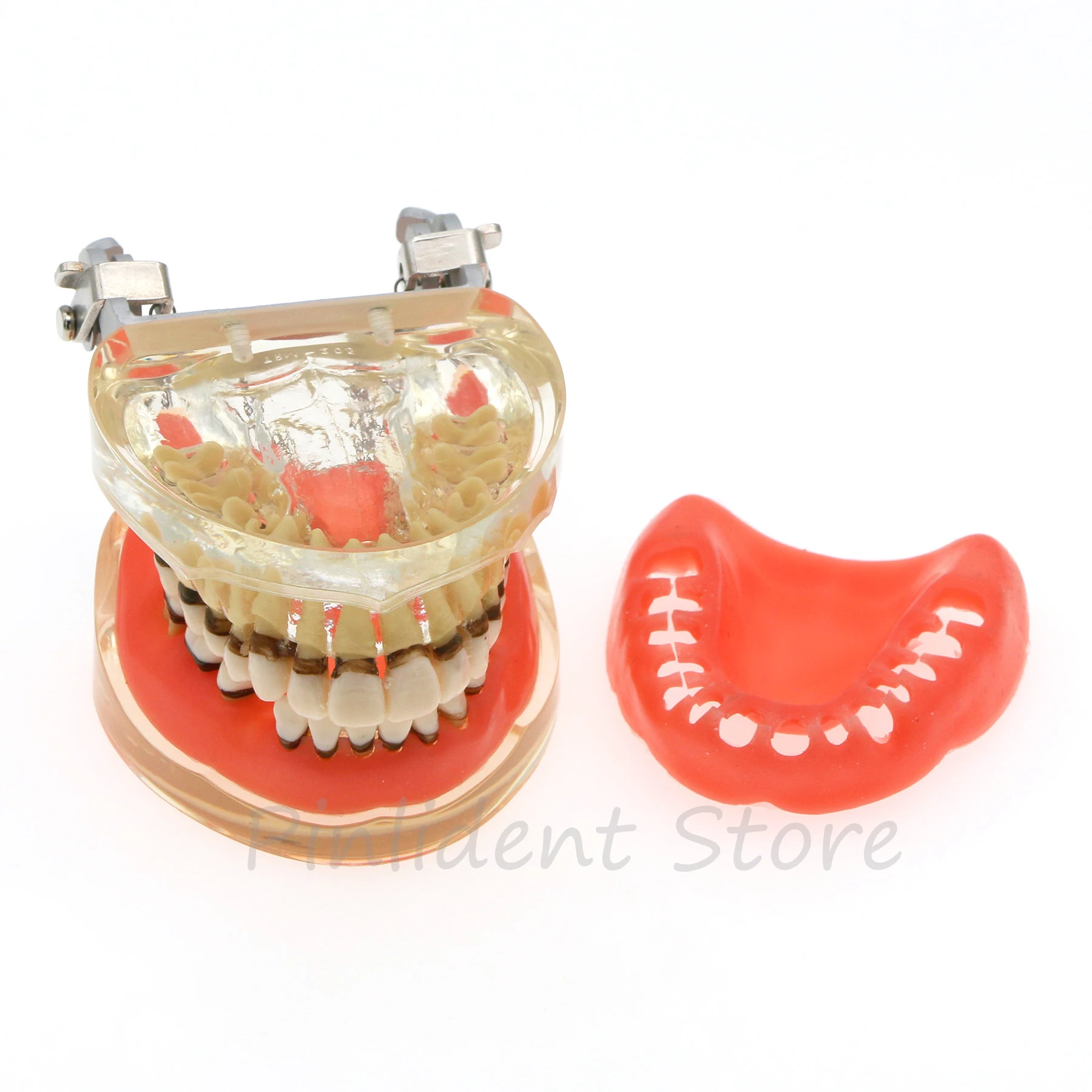 

Dental Model Dentist Teaching Periodontal Disease Pathology Patient Education Demonstration M4017