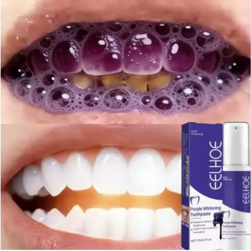 03 The best-selling whitening toothpaste of 2026: Say goodbye to yellow teeth, take care of teeth, and clean the mouth