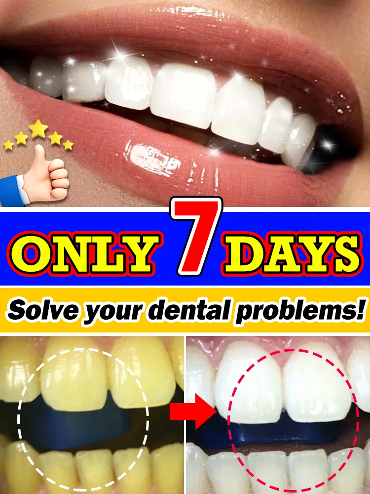 

2025 Hot Products Teeth Whitening Mousse Removes Plaque and Stains Deep Cleans Fresh Breath Oral Hygiene Dental Tools