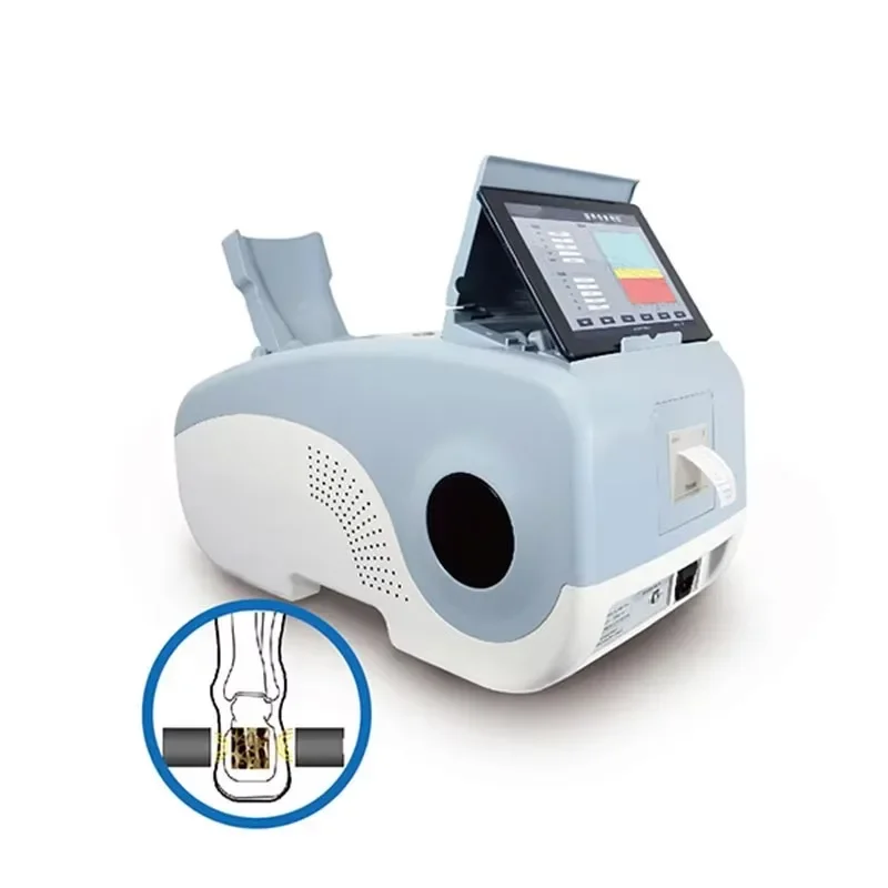 Ultrasound Bone Densitometer Hospital Use Portable Bone Densitometer for Adult and Children Bone Density Meter