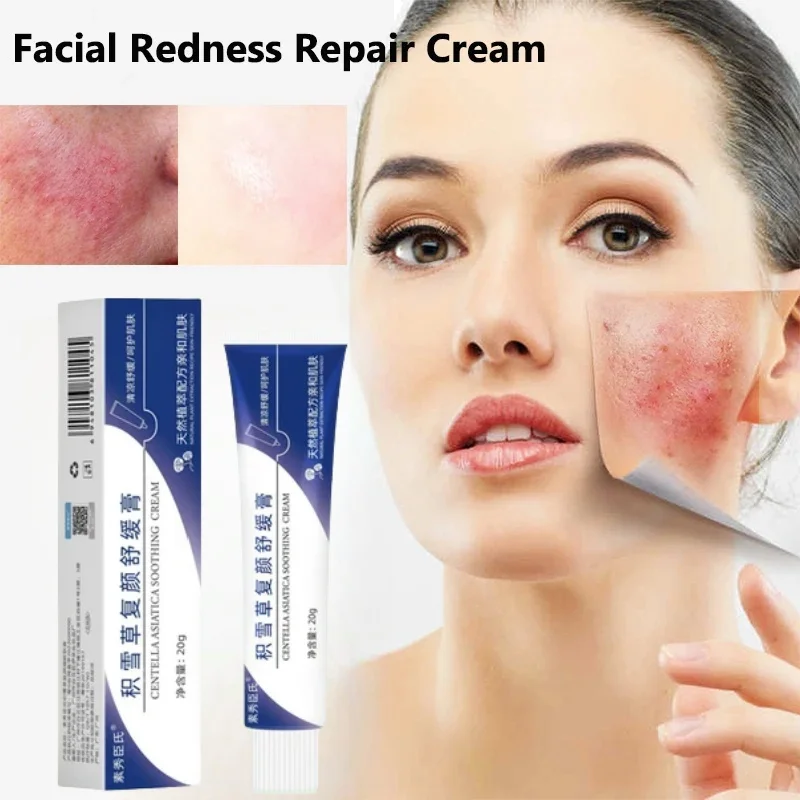 Instant Facial Redness Repair Cream Soothing Red Blood Rosacea Treatment Improve Sensitive Skin Moisturizer Skin Care Cosmetics