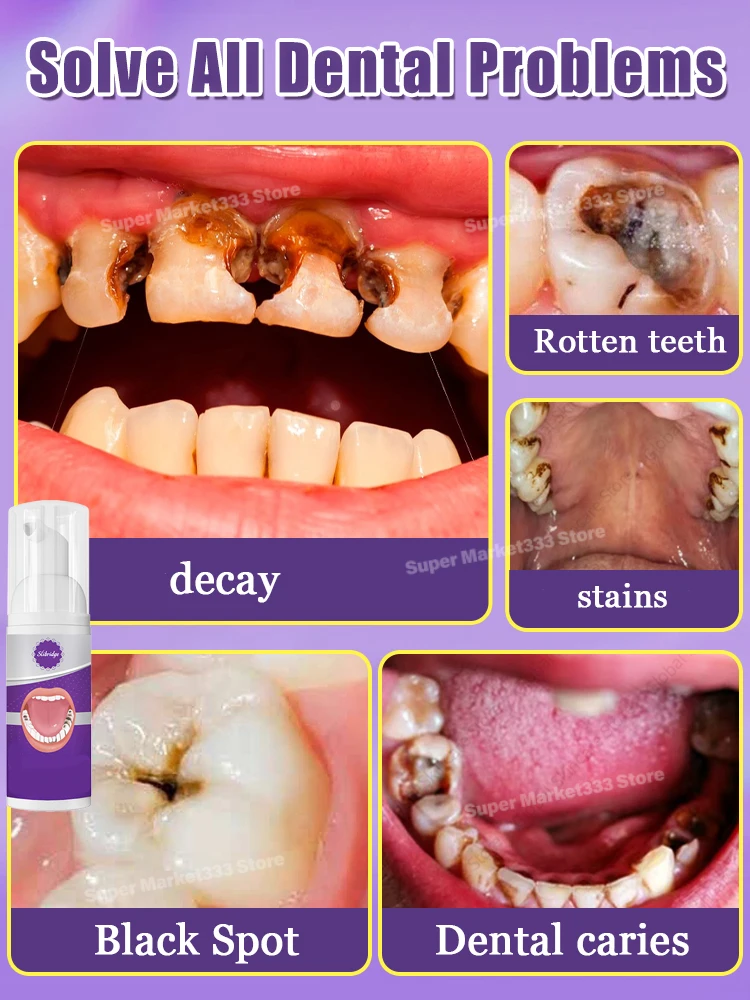 Solve all dental problem tooth decay repair tooth repair fast teeth whitening clean teeth teeth repair cavities