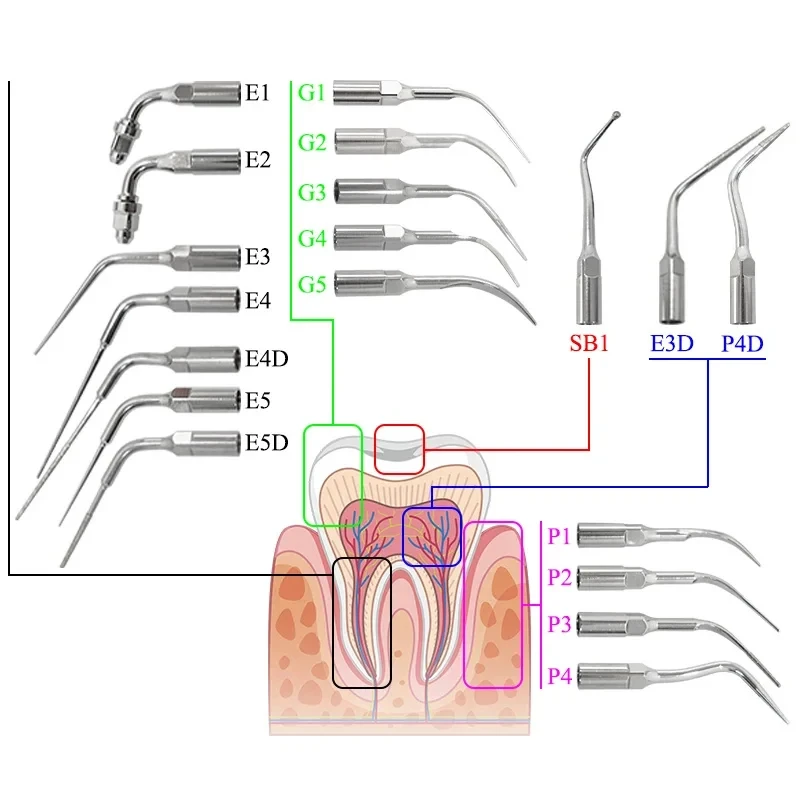 Ultraschall-Scaler-Spitzen für EMS Woodpecker Handstück zur Entfernung von Zahnstein – Zahnarztwerkzeug für die tägliche Reinigung – Scaling-Spitze – Detail 2