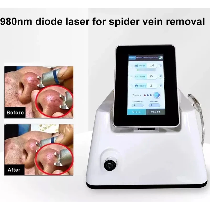 980nm Diode Laser Vascular Spider Veins Removal Machine Non-invasive Blood Vessels Treatment Beauty Health Equipment