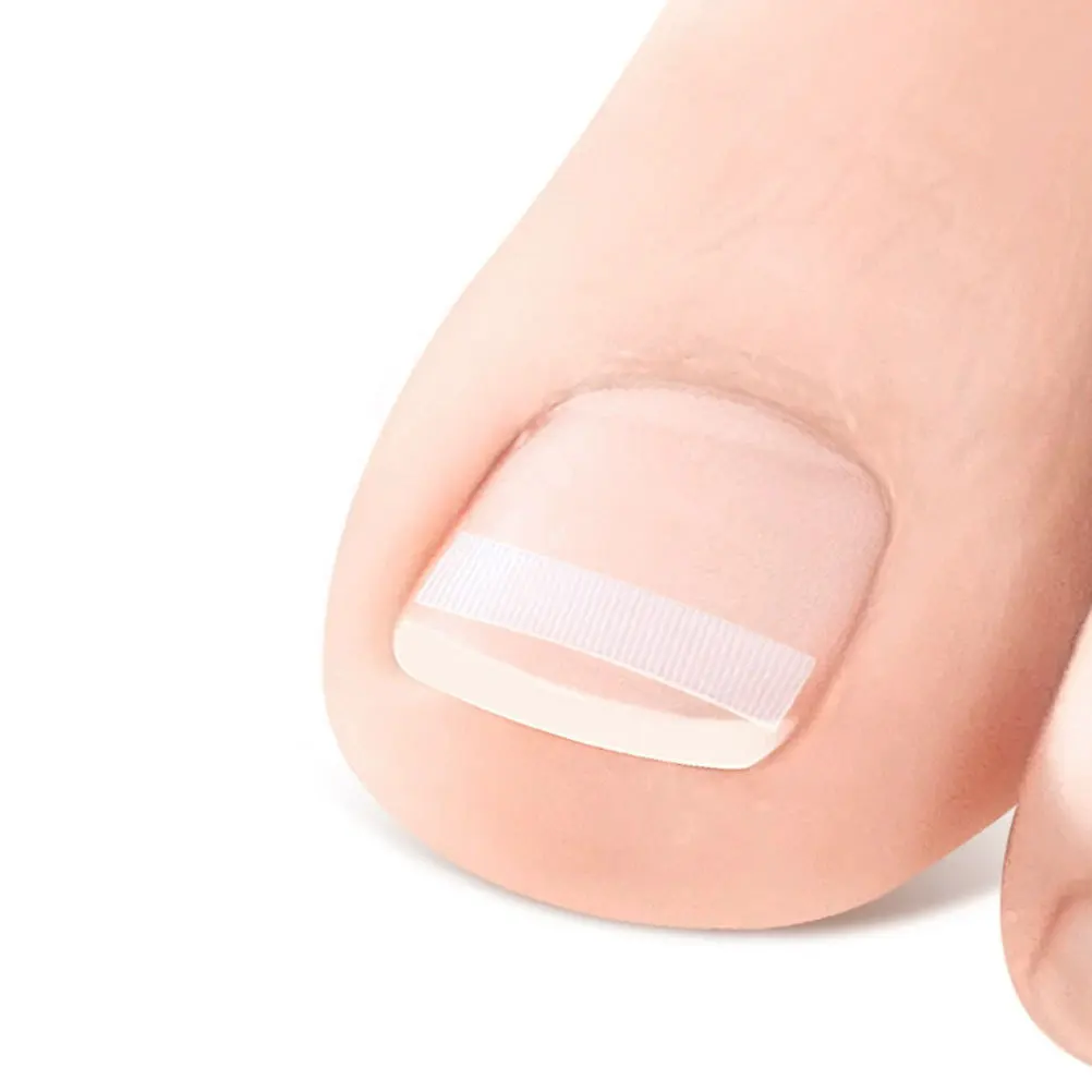 5Pcs Atmungsaktive Eingewachsene Zehennagel Korrektur Streifen Transparent Nagel Haarglätter Big Toe Pflege Behandlung Werkzeug Zehennagel Pflege Streifen