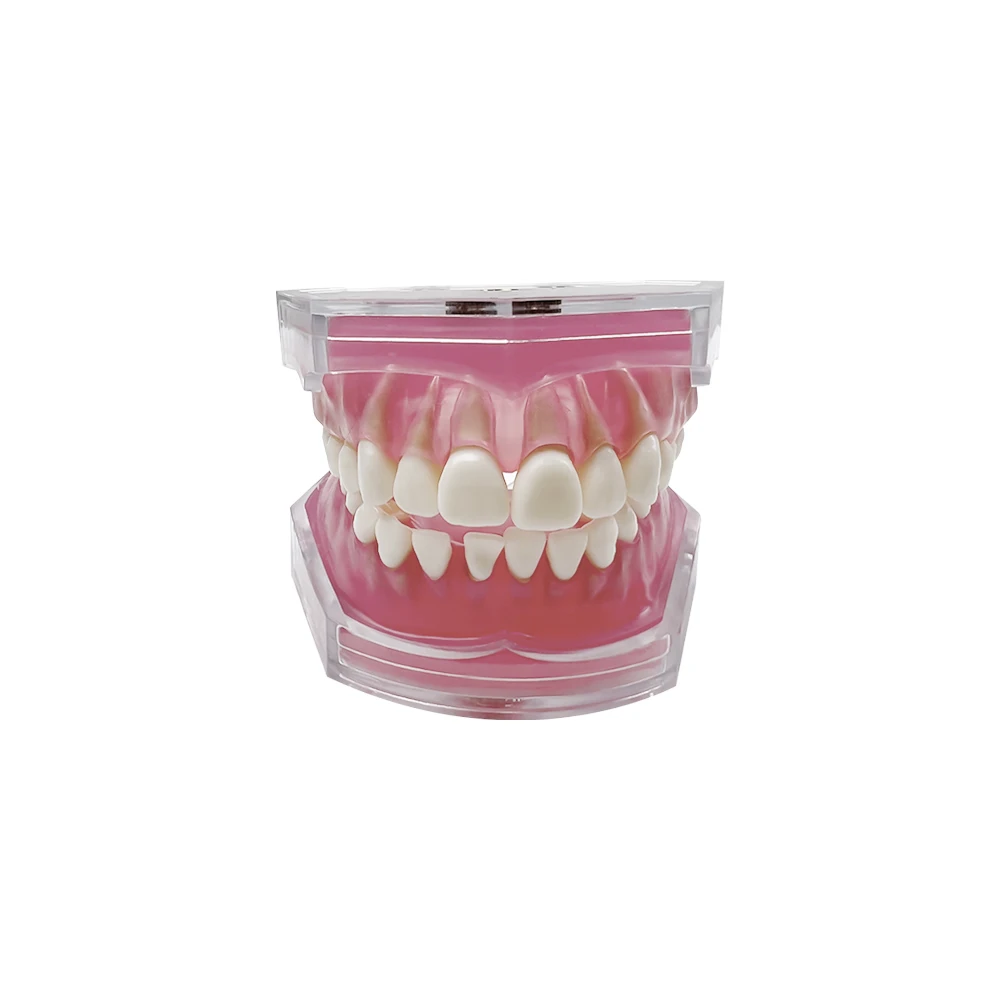 Dental Standard Practice Typodont Soft Gum Teeth Model Training Teeth Jaw Models With 28 Removable Teeth Dentistry Teaching