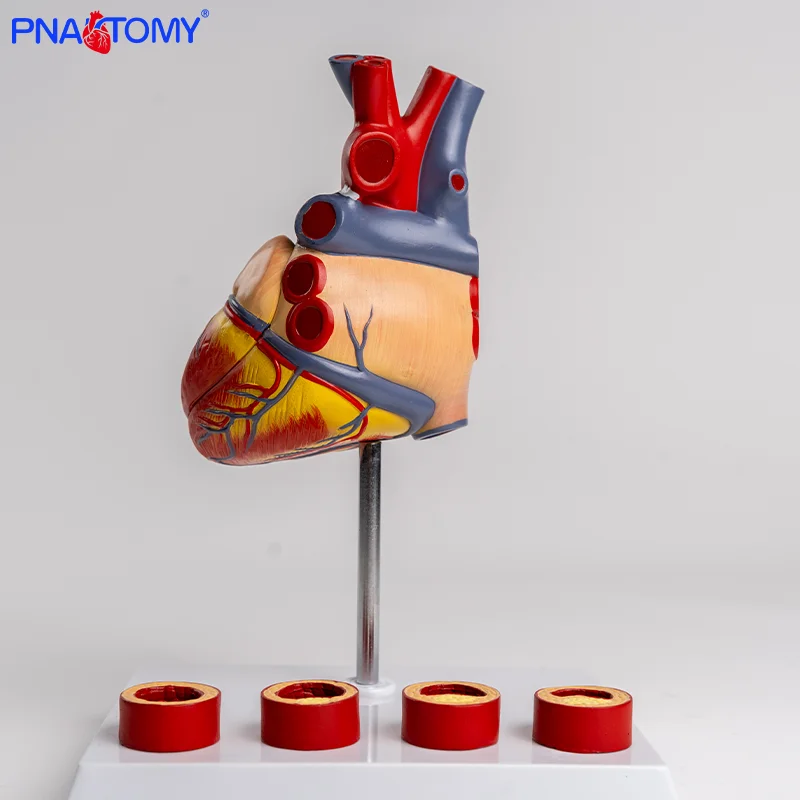 Heart Thrombus Model Anatomically Dissectable Teaching Simulation Natural-sized Heart Thrombus Vascular Model