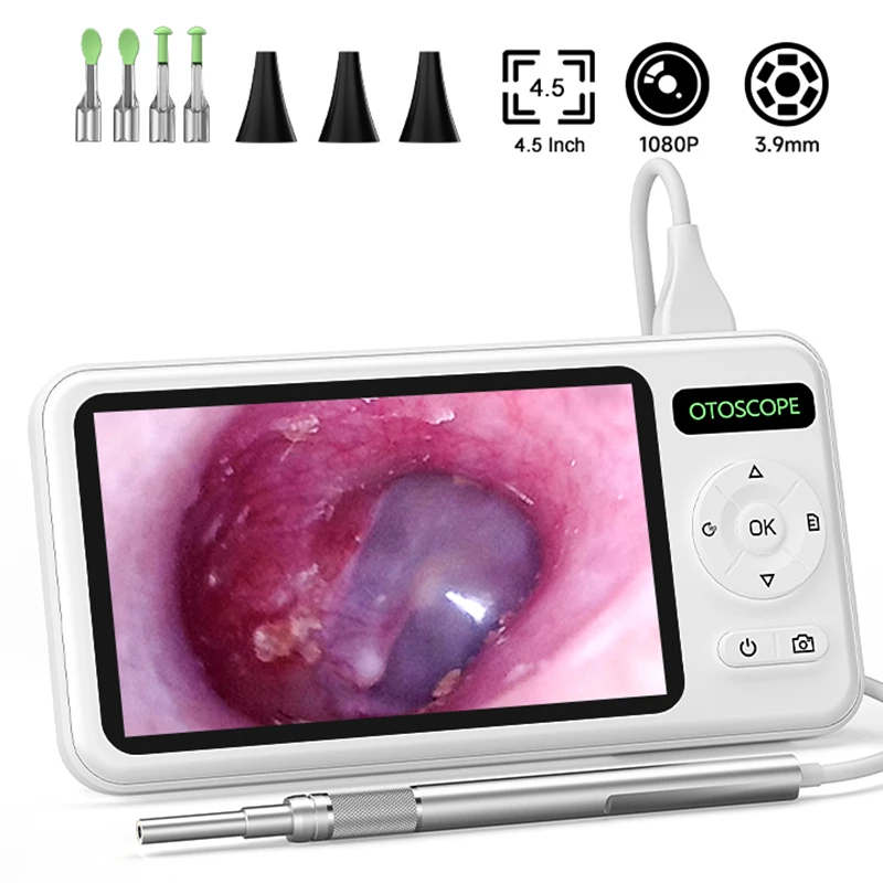 

Цифровой отоскоп 4,5 дюйма HD1080P 3,9 мм, объектив, ушная камера, 6 светодиодов, инструмент для удаления ушной серы, фотоинспекция ушей для детей и взрослых