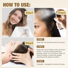 Ginger Hair Growth Spray 30ml #6