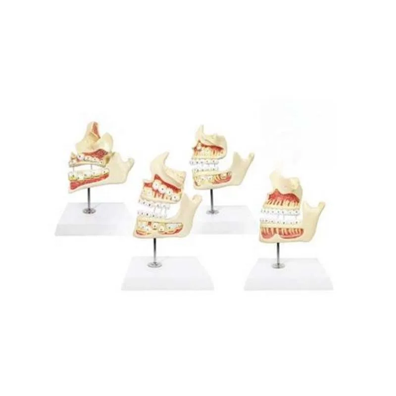 4-Stage Dental Development Teeth Model Medical Science Teaching Demonstration PVC Material