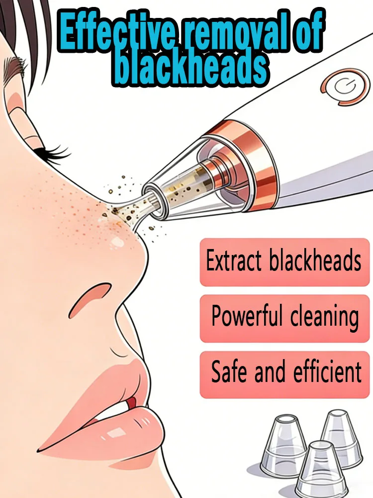 

Аппарат для чистки лица, удаления омертвевшей кожи и черных точек, вакуумный очиститель для кожи, в наличии, быстрая доставка