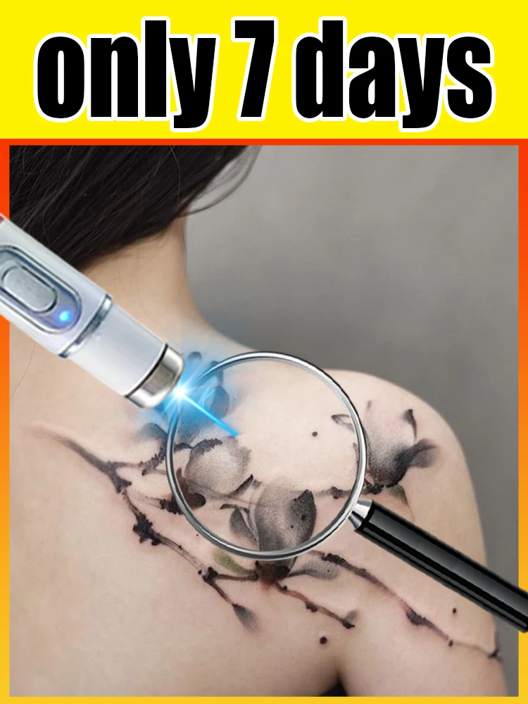 ₜₐₜₜₒₒ ₗₐₛₑᵣ ₚₒᵢₙₜₑᵣ ₜₕᵢᵣd gₑₙₑᵣₐₜᵢₒₙ ᵦₗᵤₑ ₗᵢgₕₜ ₙₑw ᵤₚgᵣₐdₑ