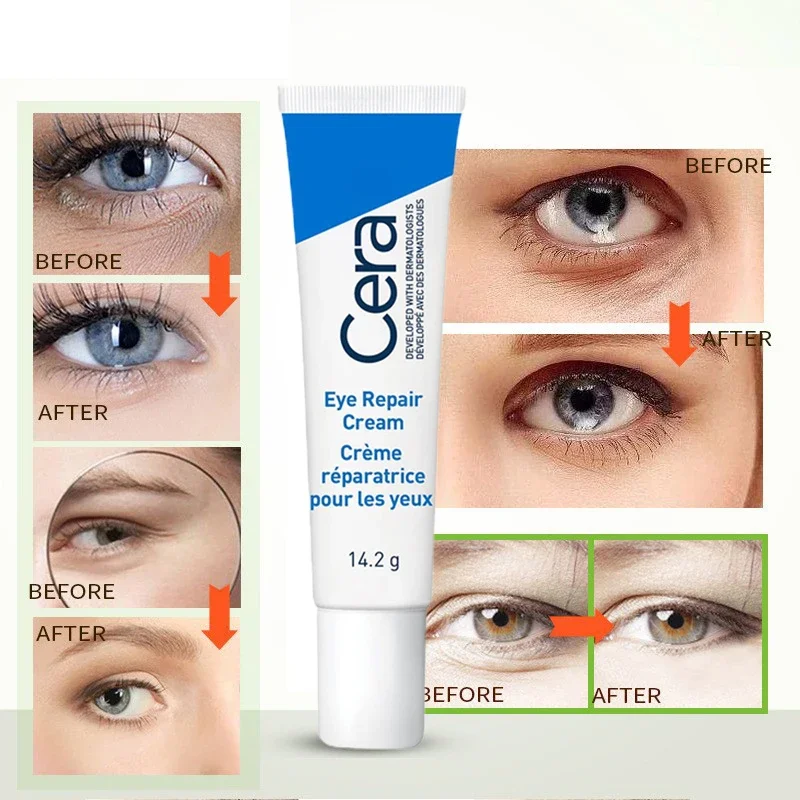 Crème anti-déformable pour les yeux au rétinol, dissolvant de poches sous les yeux, estompe les ridules, hydratante, beauté, santé