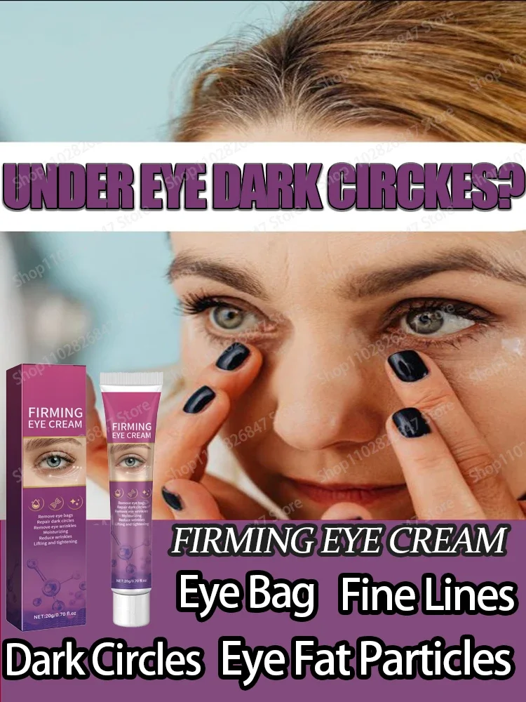 

Eye Cream Lighten Eye Bags Remove Dark Circles Diminish Fine Lines Dark Circles Moisturizes Eye Care