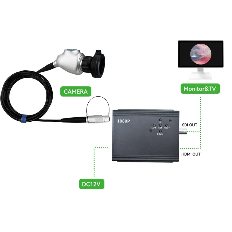 

New arrival 2.8 so ny cmos 1080P 60fps 3G SDI ENT Endoscopic HD Ca mera