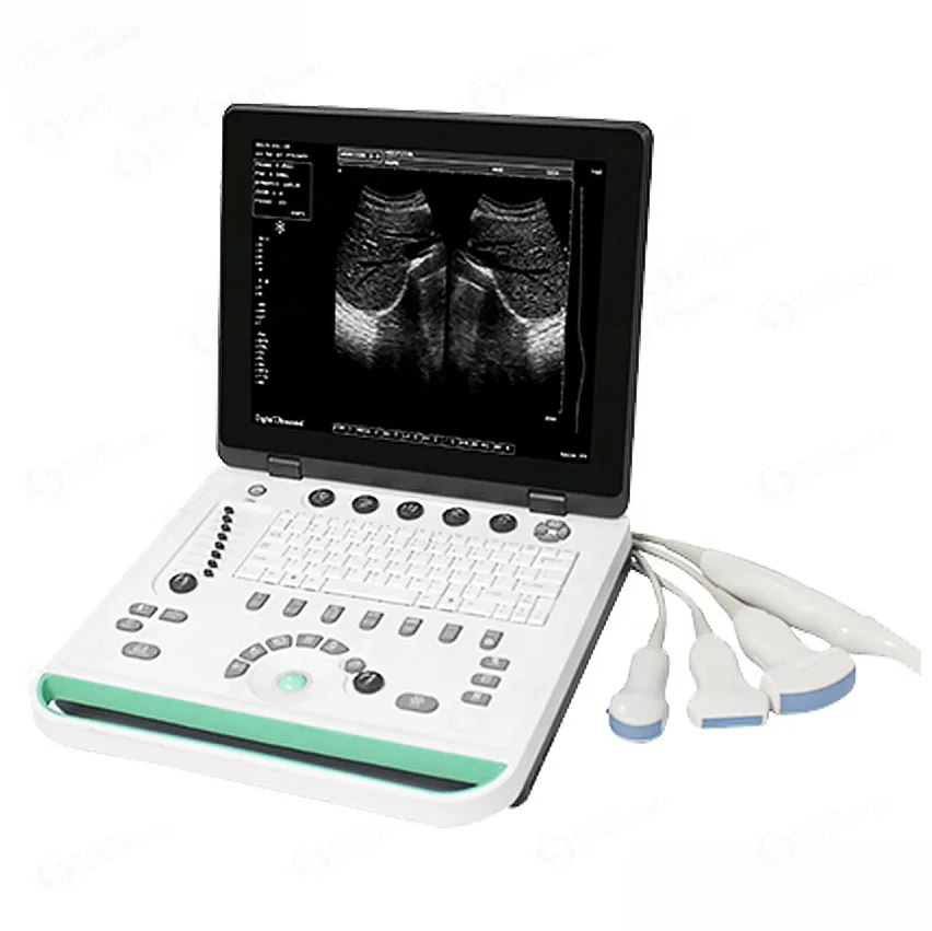 Portable 15in LCD Laptop Medical Ultrasound Scanner