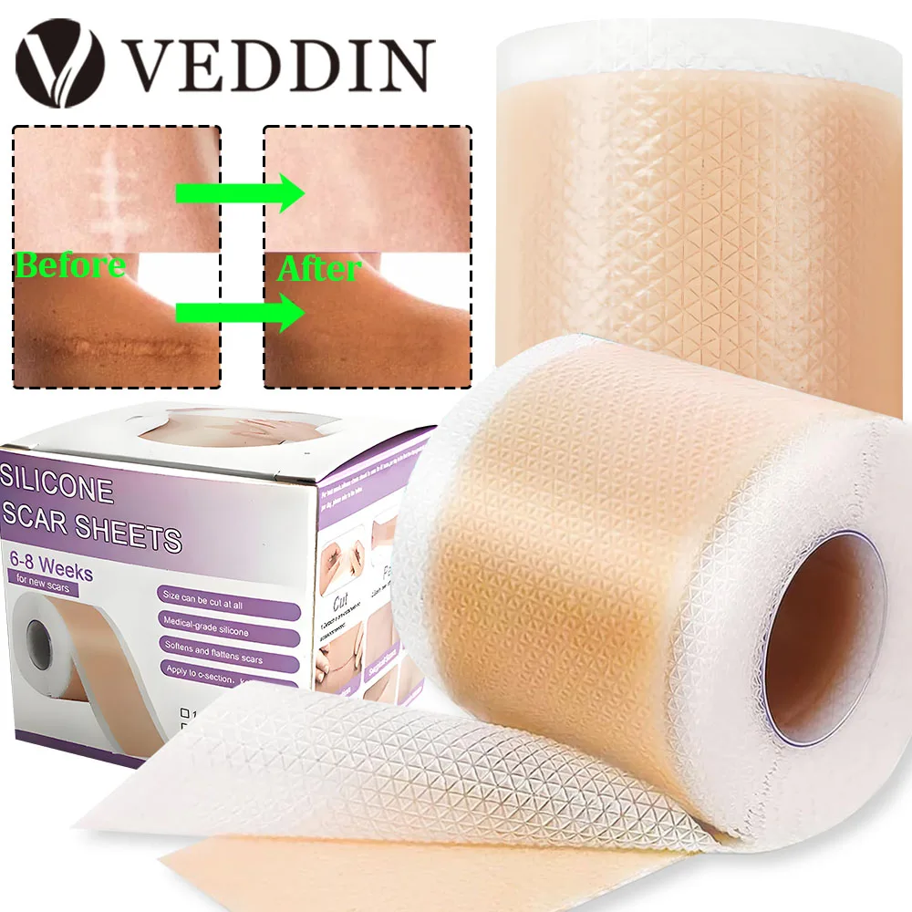 

Профессиональные силиконовые листы для шрамов 1,5 м/3 м самоклеящиеся ленты для покрытия шрамов эффективные полоски для ухода за кожей силиконовые листы для шрамов поставка