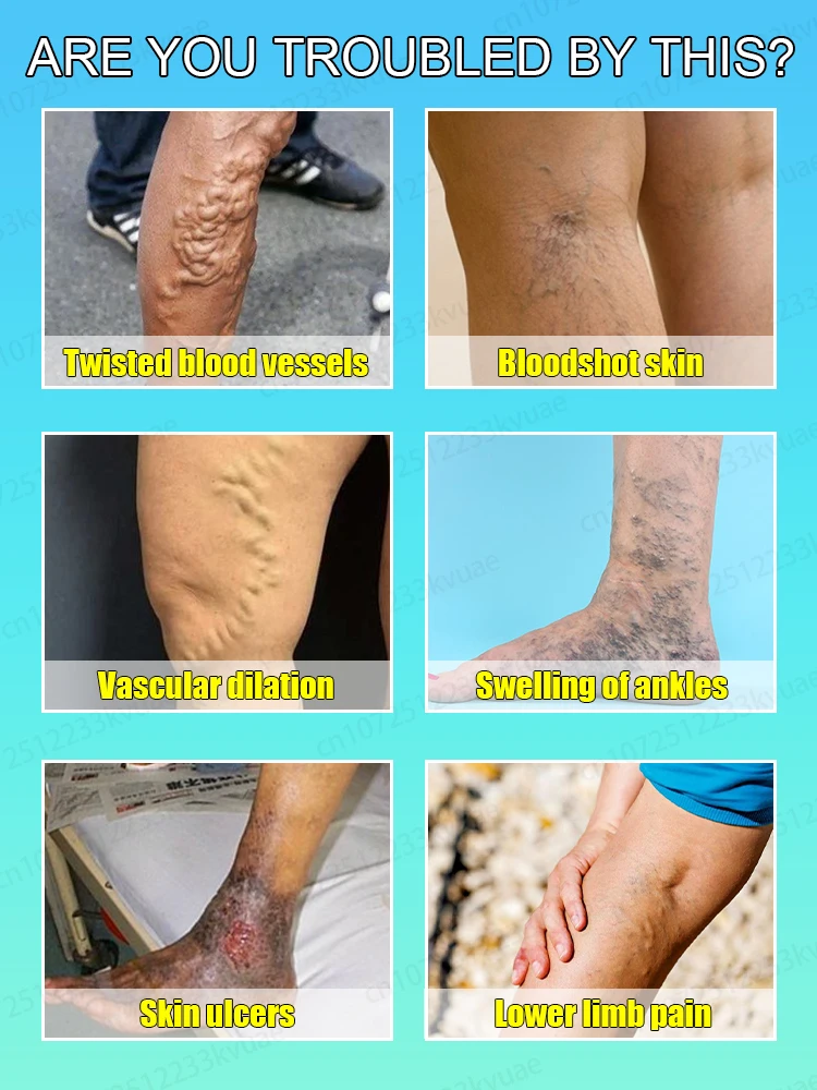 Hᴇᴀʟᴛʜʏ ʟᴇɢs ᴍᴀᴋᴇ ʏᴏᴜ ғᴇᴇʟ ᴄᴏᴍғᴏʀᴛᴀʙʟᴇ ɴᴏ ᴍᴀᴛᴛᴇʀ ʜᴏᴡ ʏᴏᴜ ᴍᴏᴠᴇ